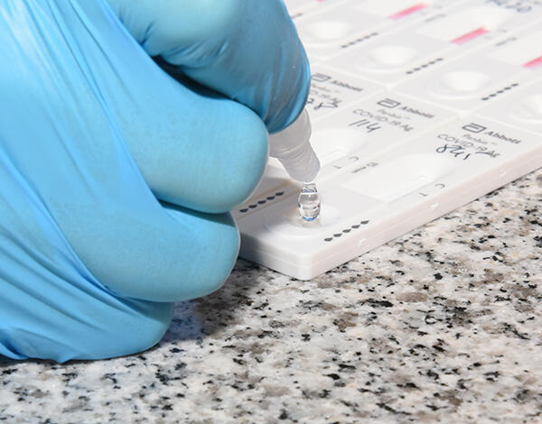 SESARAM realizou 1573 testes rápidos no Funchal