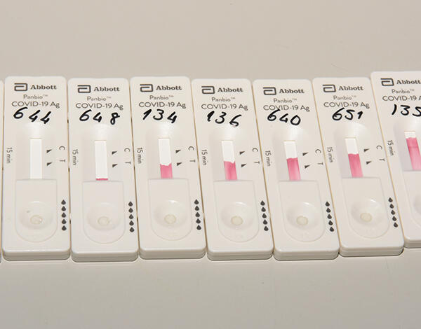 SESARAM disponibiliza testes rápidos aos lares